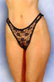 String l'Original