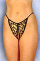 Tanga � Ouverture